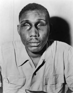 Photo of Isaac Woodard taken after be beaten blind in 1946